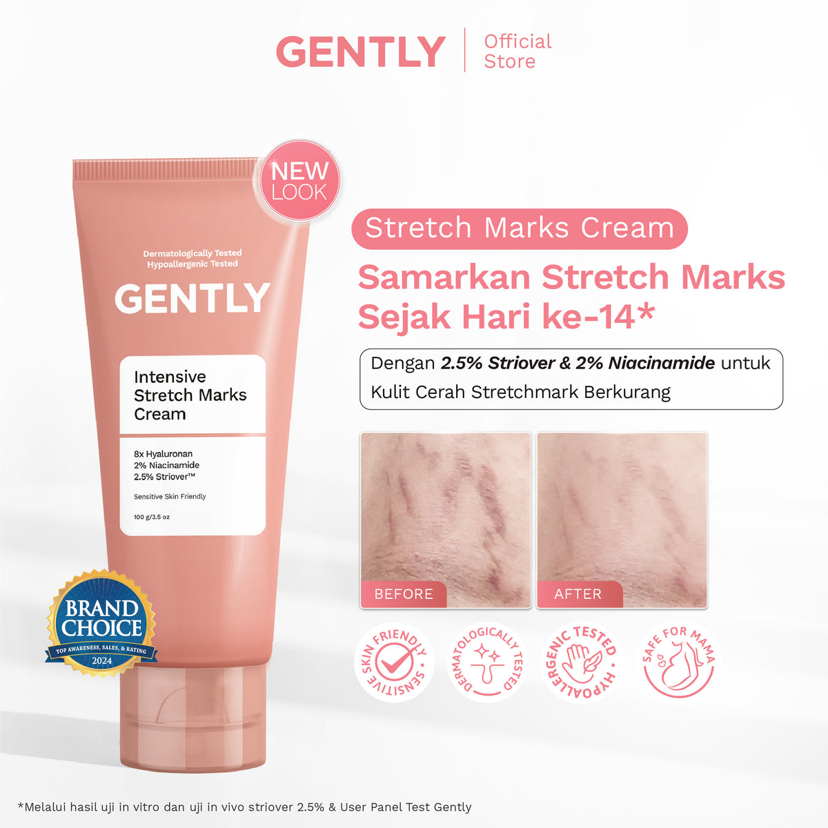 GENTLY Stretch Marks Combo | Intensive Stretch Marks Cream 100 g + Advanced Stretch Marks Oil Serum 50 ml