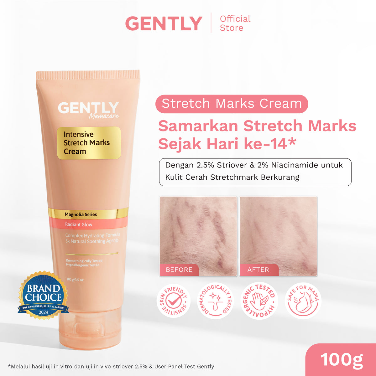 GENTLY Paket Mama Tenang & Nyaman | Intensive Stretch Marks Cream 40g + Relaxing Body Cream 50g