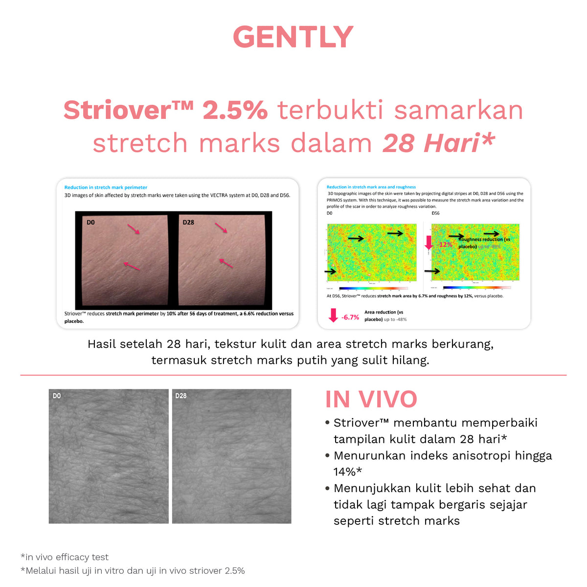 GENTLY Stretch Marks Cream 3 Pcs