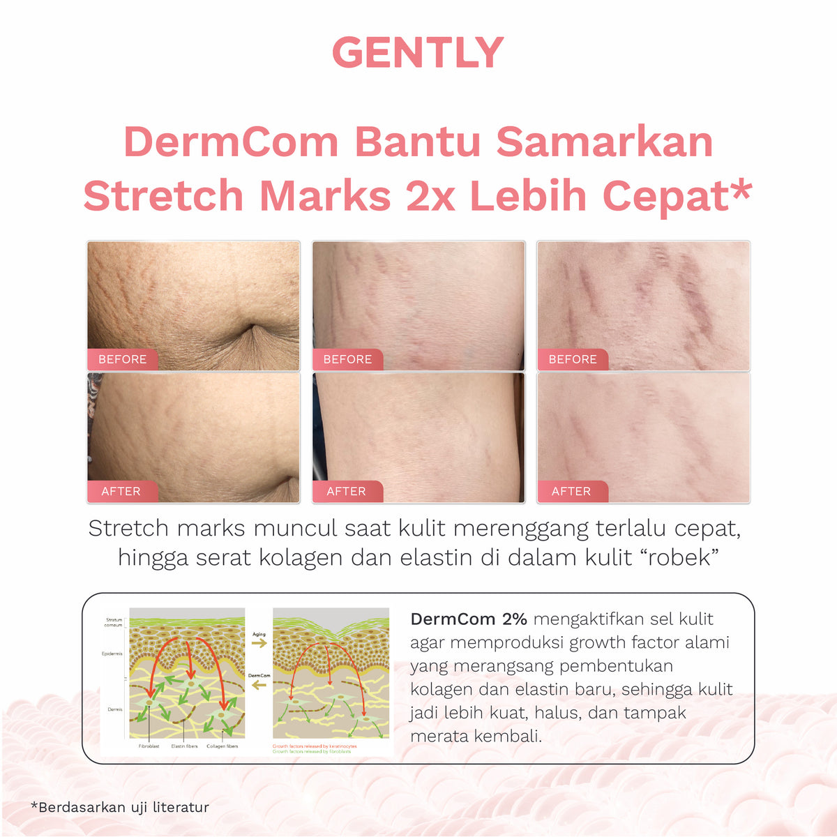 GENTLY Advanced Stretch Marks Oil Serum | Arnica Oil + 5x Ceramide + Magnolia Extract + 3% Niacinamide Snow Crocus Extract + Vegan Collagen | Skincare Ibu Hamil dan Menyusui Terdaftar BPOM | Oil Serum untuk Menyamarkan Peregangan Kulit