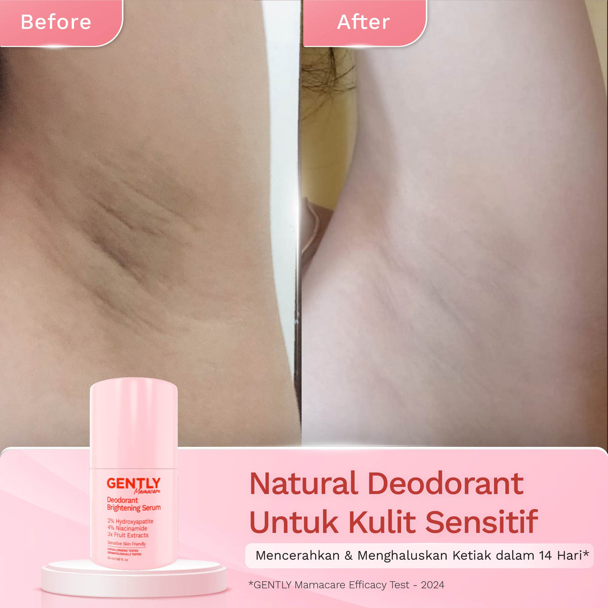 GENTLY Deodorant Brightening Serum | Menahan bau & keringat, dan Mencerahkan Ketiak I Non Aluminum
