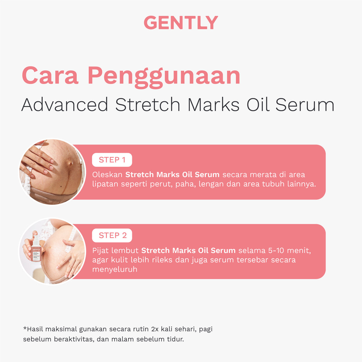 GENTLY Advanced Stretch Marks Oil Serum | Arnica Oil + 5x Ceramide + Magnolia Extract + 3% Niacinamide Snow Crocus Extract + Vegan Collagen | Skincare Ibu Hamil dan Menyusui Terdaftar BPOM | Oil Serum untuk Menyamarkan Peregangan Kulit