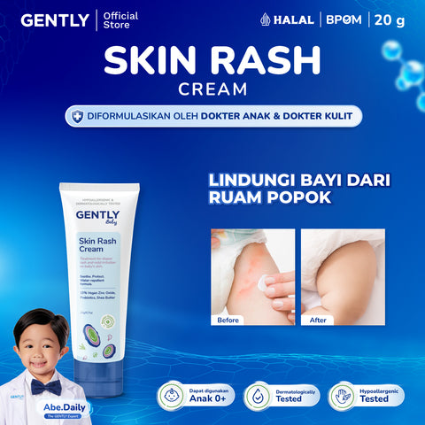 GENTLY  Baby Rash Cream 20 gr | Krim Pereda Ruam Popok pada Bayi