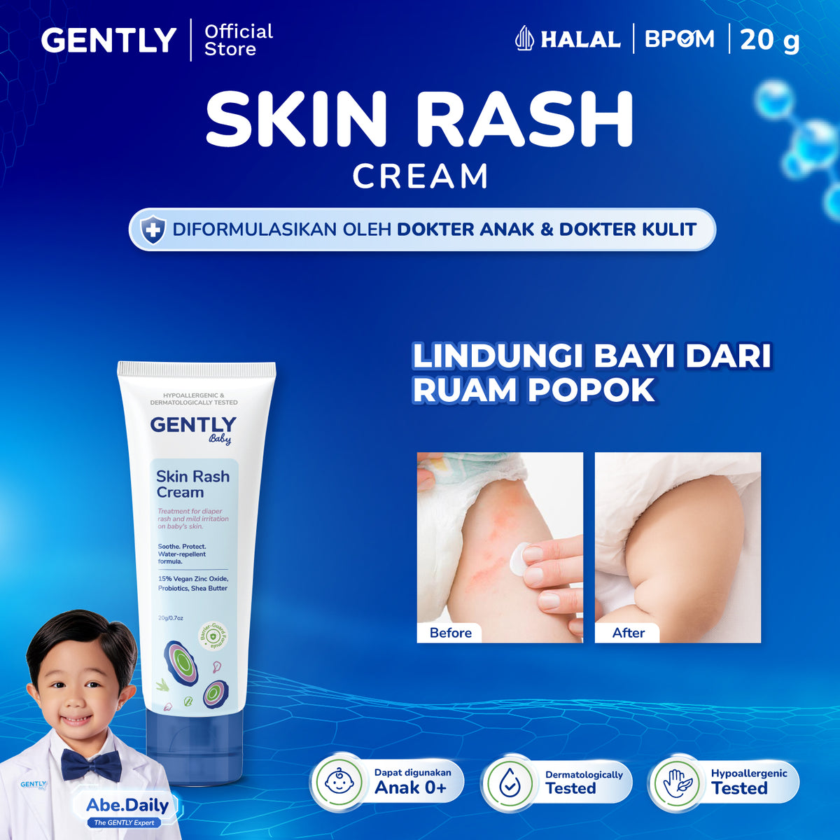 GENTLY  Baby Rash Cream 40 gr | Krim Pereda Ruam Popok pada Bayi
