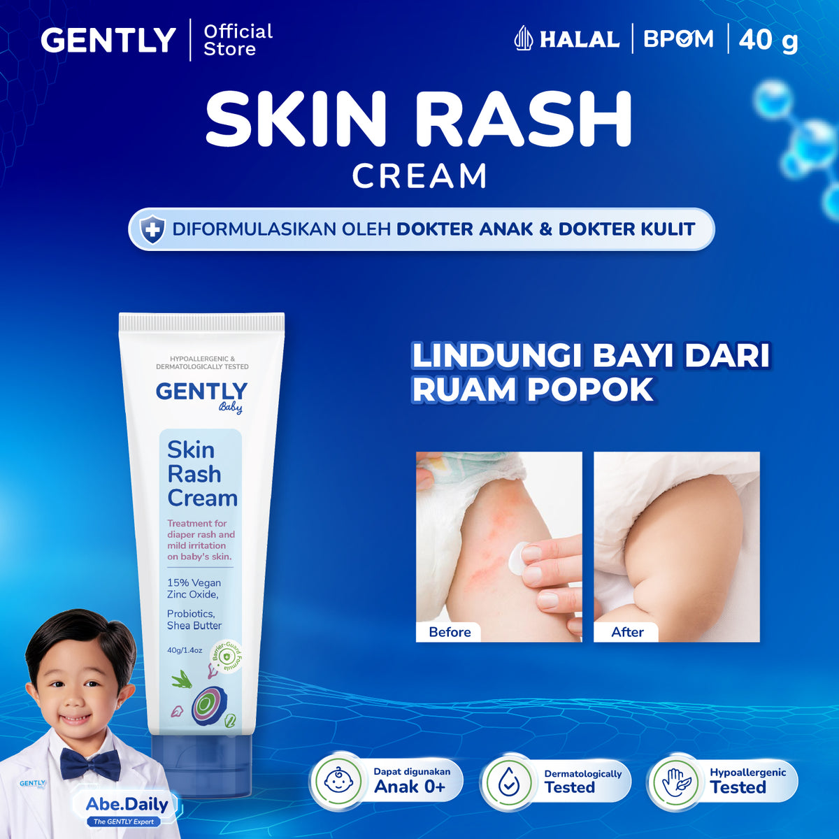 GENTLY  Baby Rash Cream 40 gr | Krim Pereda Ruam Popok pada Bayi