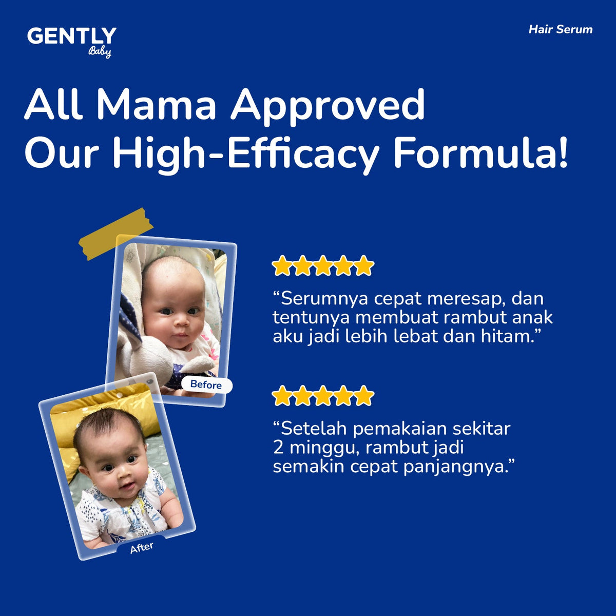 GENTLY Baby Hair Serum 100ml | Serum Penumbuh & Penyubur Rambut Bayi dan Anak | Haircare Bayi & Anak-Anak