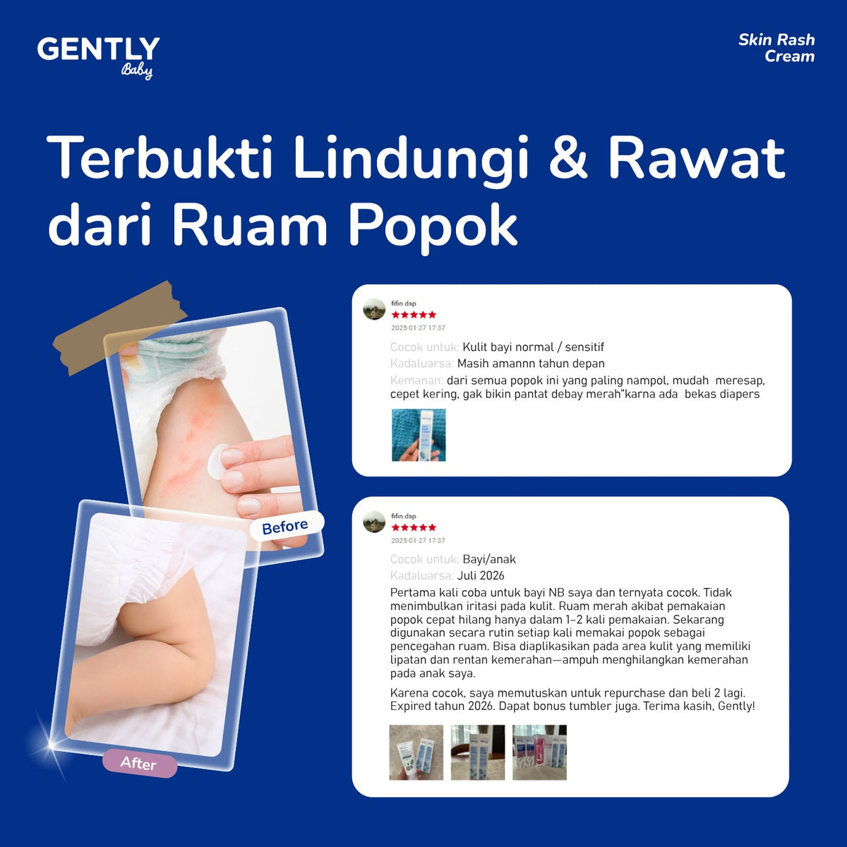 GENTLY  Baby Rash Cream 40 gr | Krim Pereda Ruam Popok pada Bayi